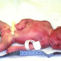 Abortionist License Revoked Over Illegal Late-Term Abortion Referrals